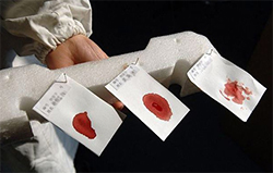 黑龙江省血缘检测在哪里能做[预约挂号]，黑龙江省亲子鉴定要多少钱的费用